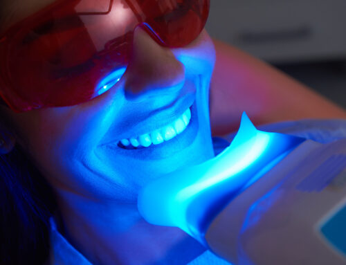 Professional vs. At-Home Teeth Whitening: Your Guide