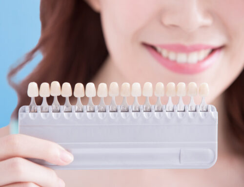 Transform Your Smile with Porcelain Veneers: A Guide