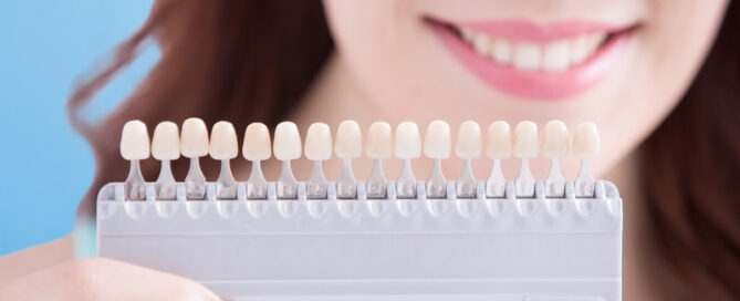 Transform Your Smile with Porcelain Veneers: A Guide