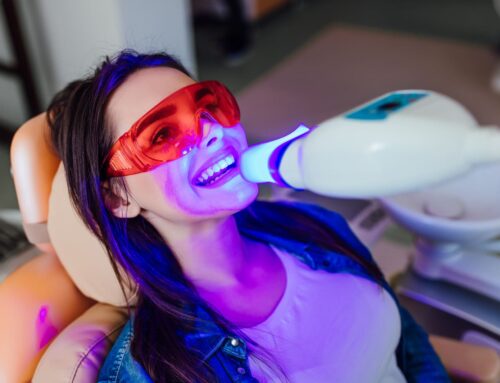 Teeth Whitening: Professional vs. DIY Methods Compared