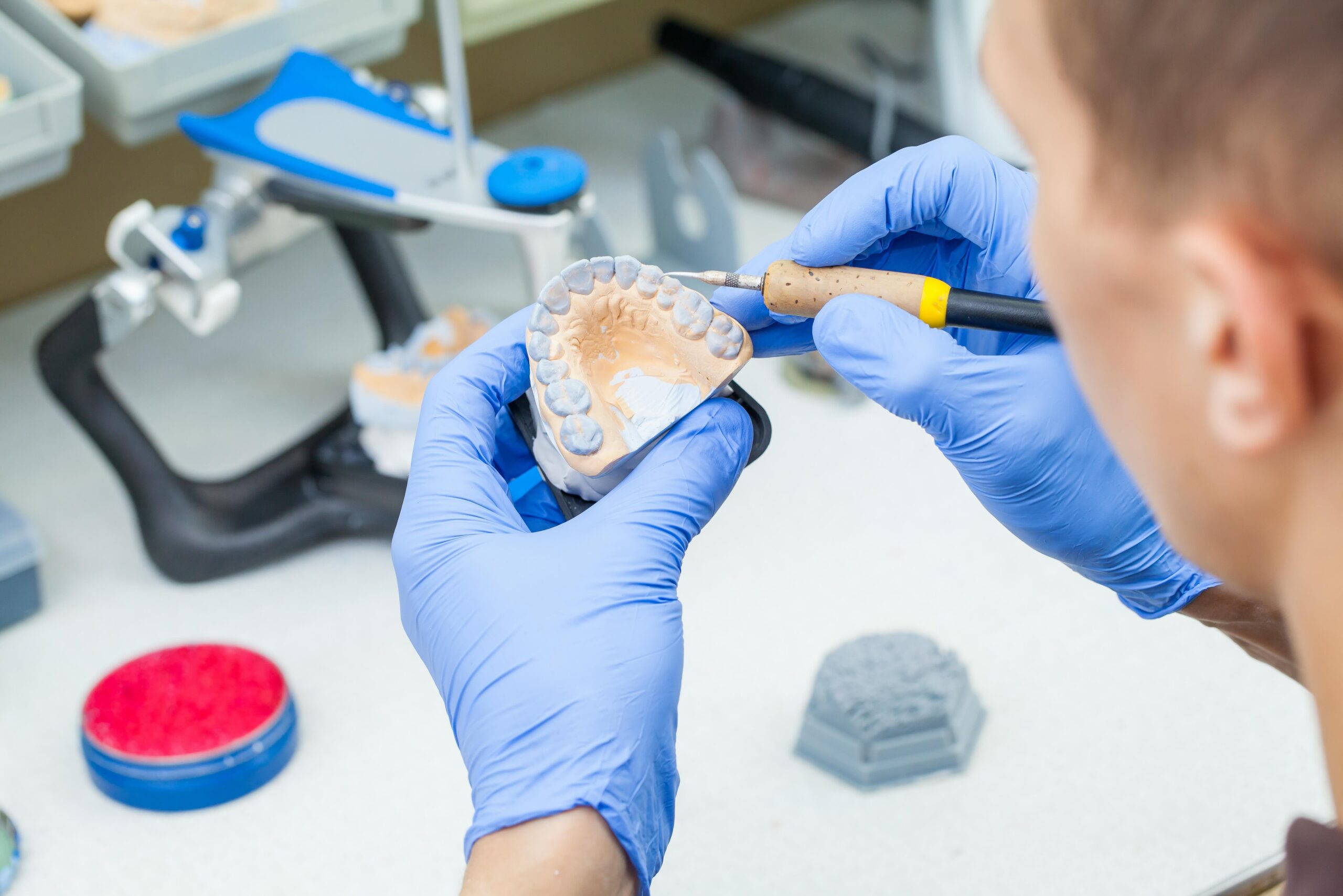 A dental technician dentist working with prostheses in a laboratory with wax on a jaw model
